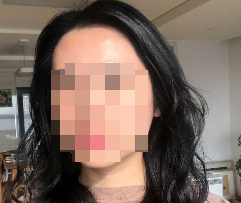 Dana plastic surgery has already been over 19 months