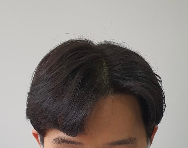 1년차 경과입니다.