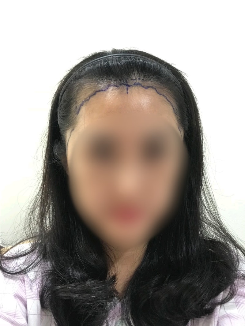 BlurImage_1-9-2019-9-31-26.jpg