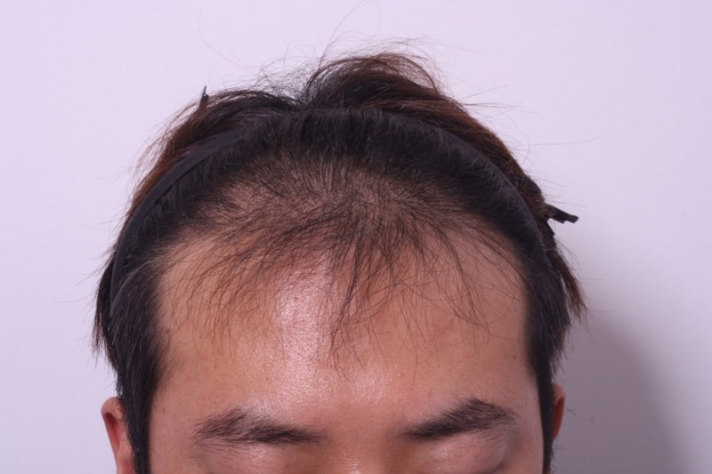 이두호전1.jpg