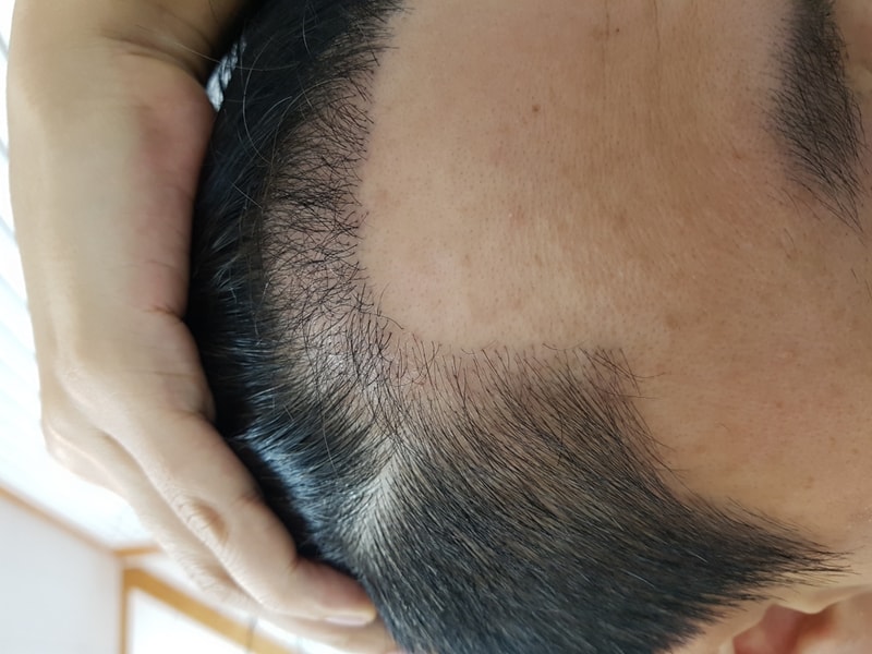 3600毛，连续3个月