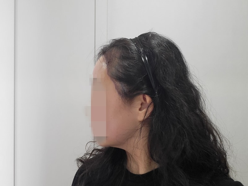 이수진 1일 왼.jpg