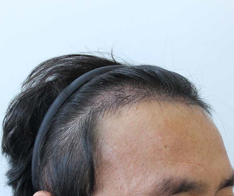 수술후2.jpg