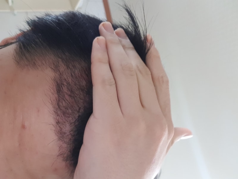移植1ヶ月目..