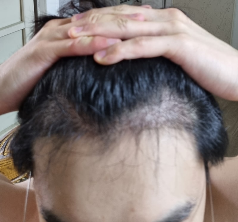 after 4 months