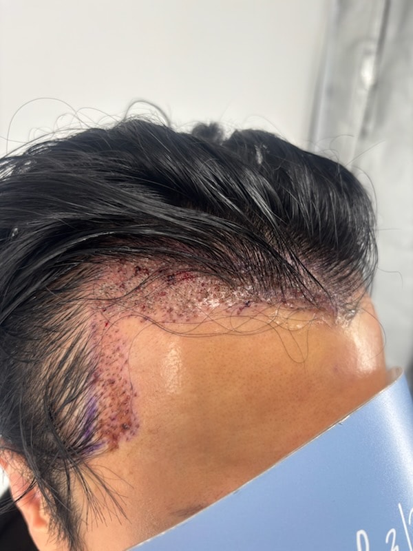 포토후기 이미지