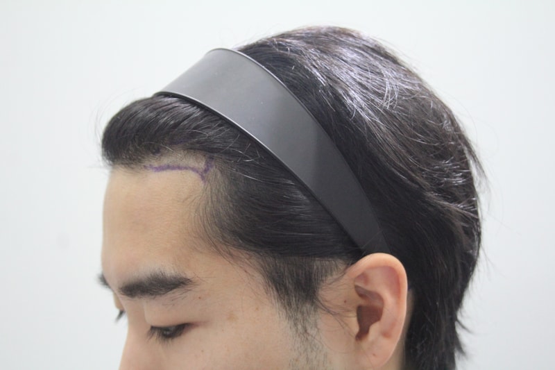 수술전디자인 1.JPG