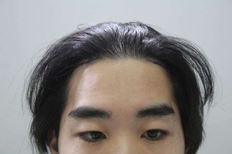 수술전디자인 11.JPG