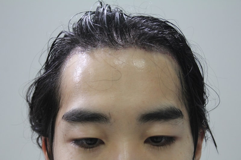 수술직후 10.JPG