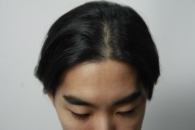 수술전 17.JPG