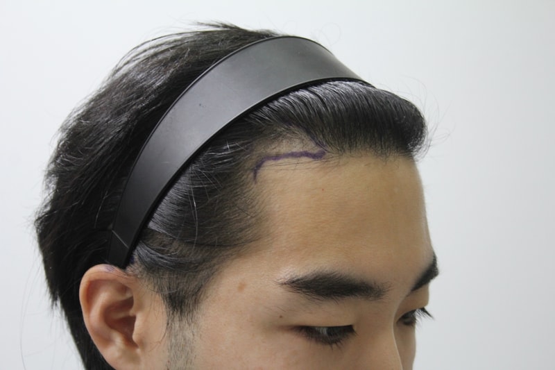수술전디자인 3.JPG