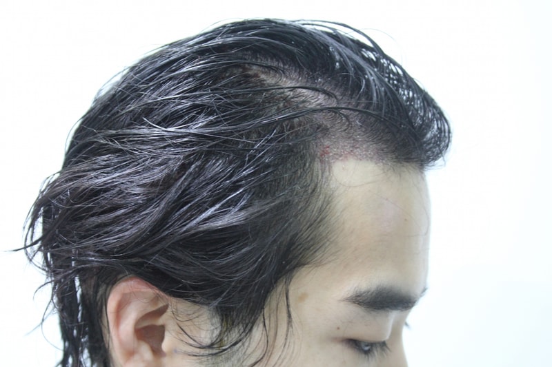 수술직후 2.JPG