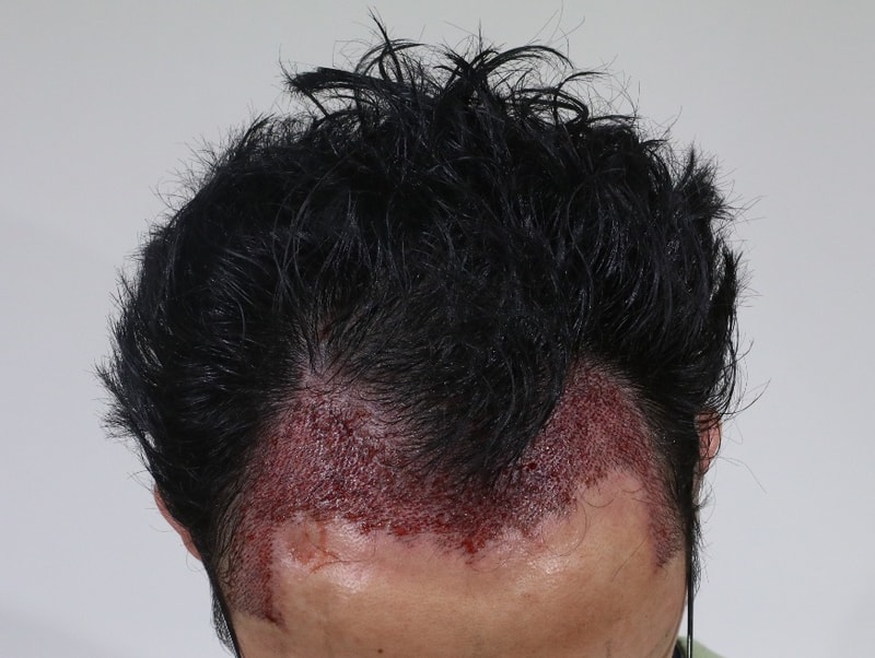 수술 후 2.jpg
