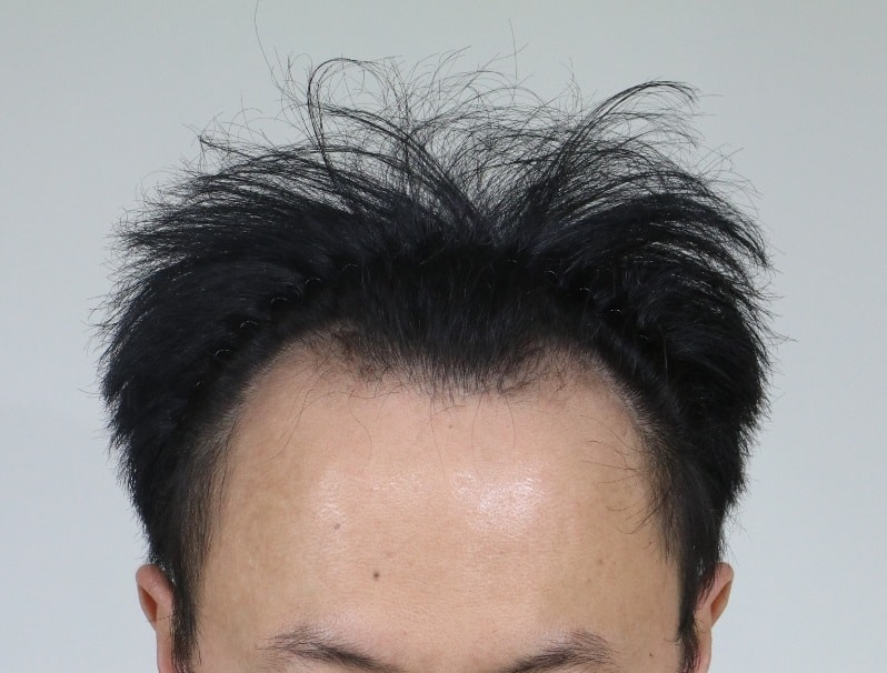 수술 전 1.jpg