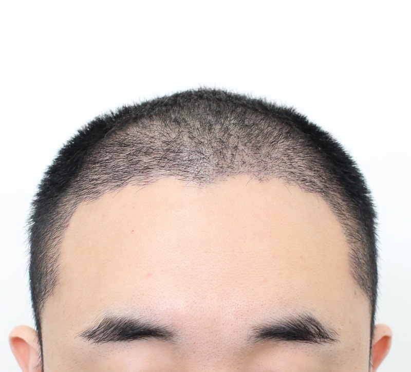 후.jpg