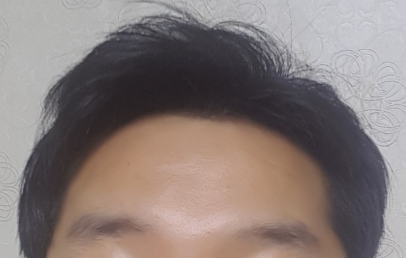5개월정면.jpg