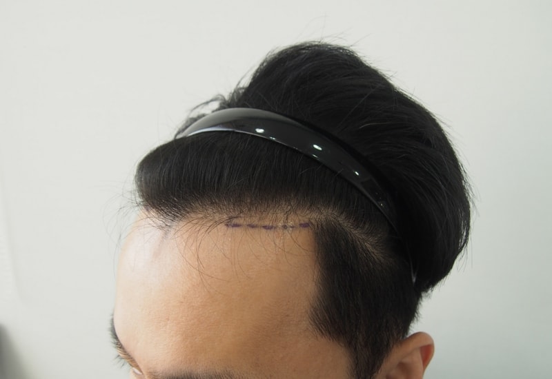 수술전2.jpg