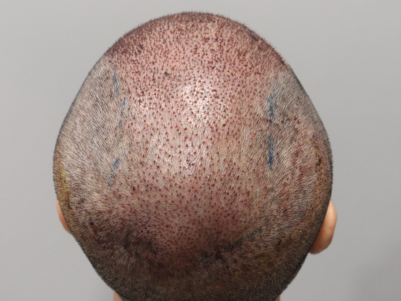 1 2.png