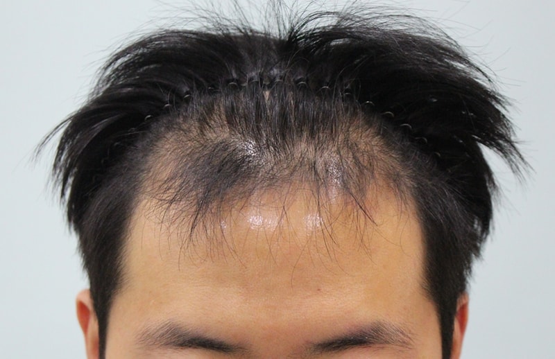 It's only three or four months.. I can definitely feel the effect
