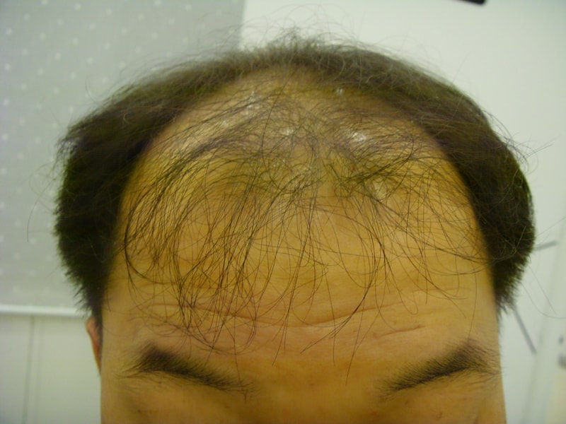 수술전.JPG