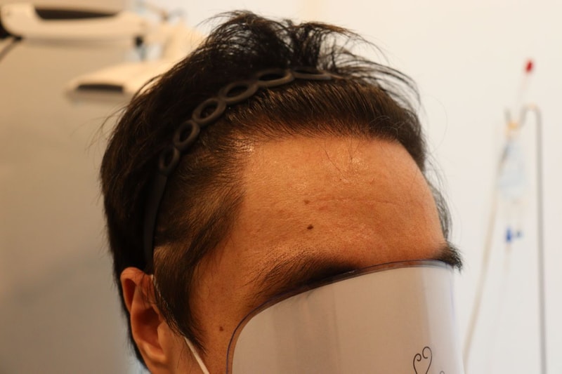수술후3.jpg