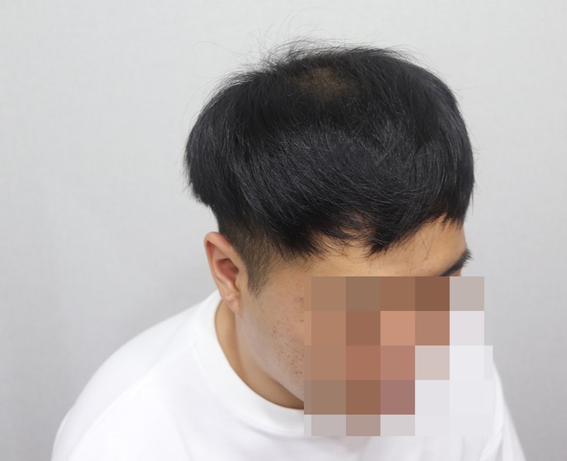 6개월3.JPG