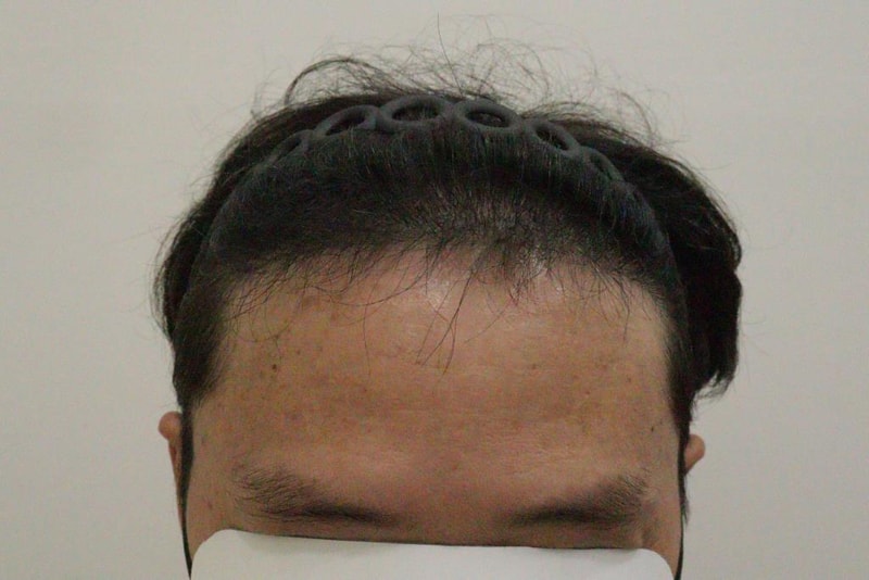 CE3B9E8C-4E8B-41C0-B6DB-763F033C44B7.jpeg