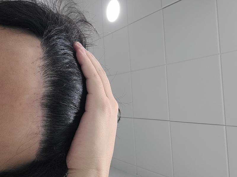 1년 경과후