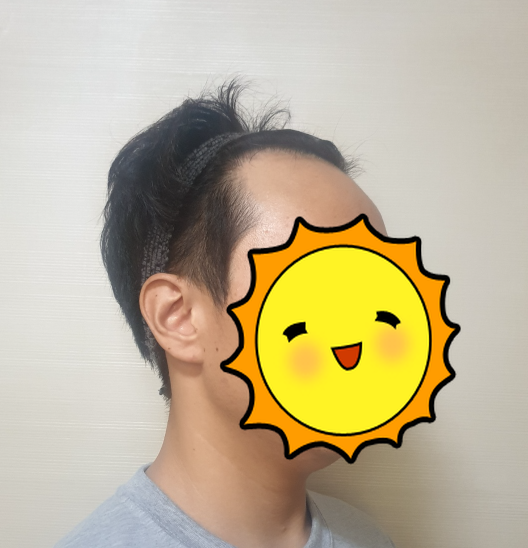 한성수 수술전2.PNG