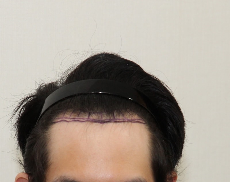 New Hair 1300 +100 Hair Ornament 7 Months