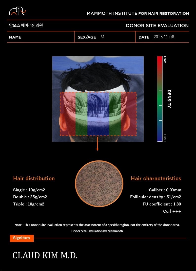 포토후기 이미지