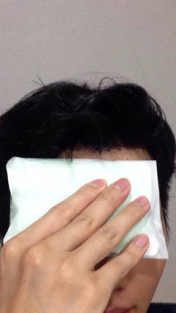 800모 수술 후기입니다~~