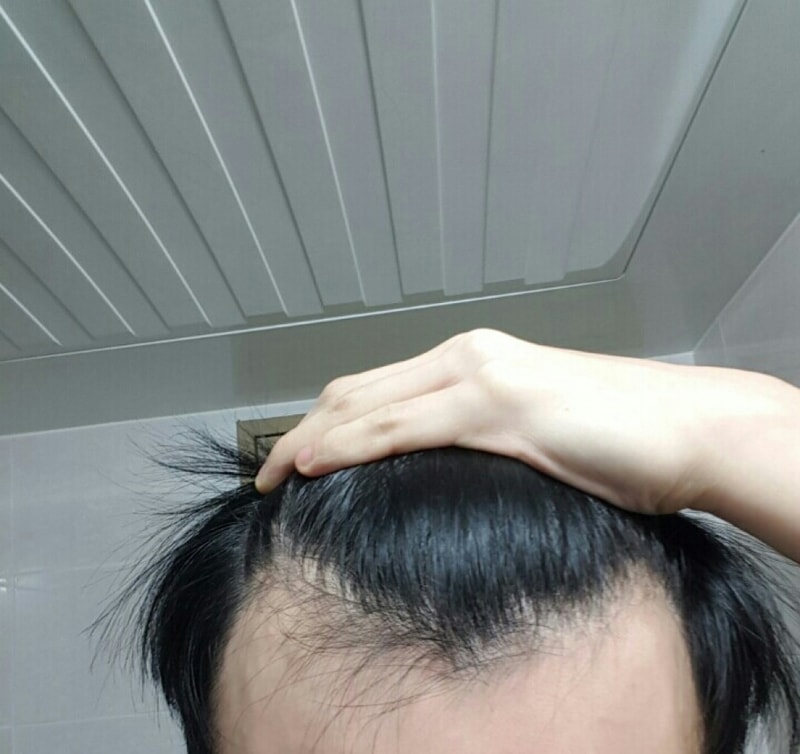 正确相报的第3个月