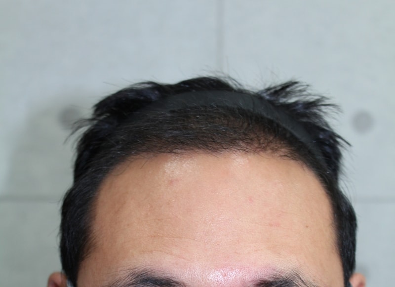 4개월정면.jpg