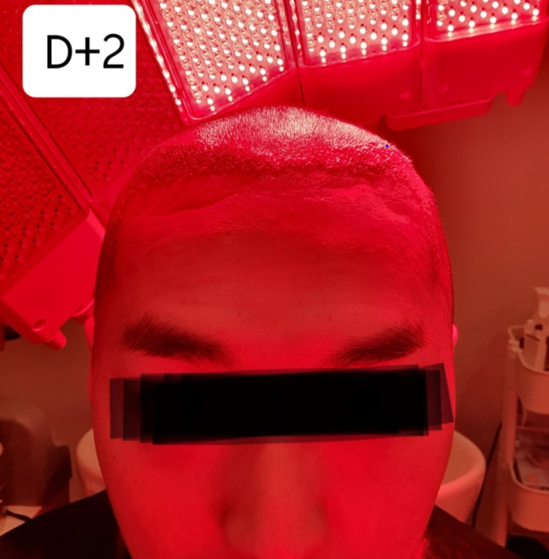 2일.PNG