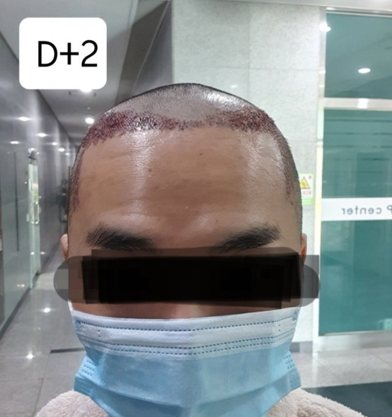 2일2.PNG