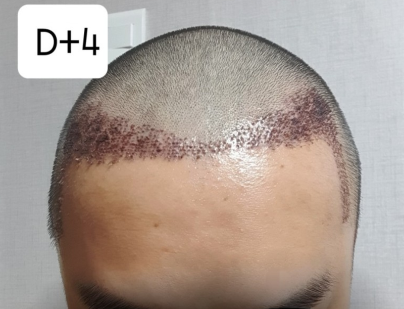 4일.PNG