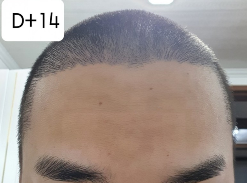 14일.PNG