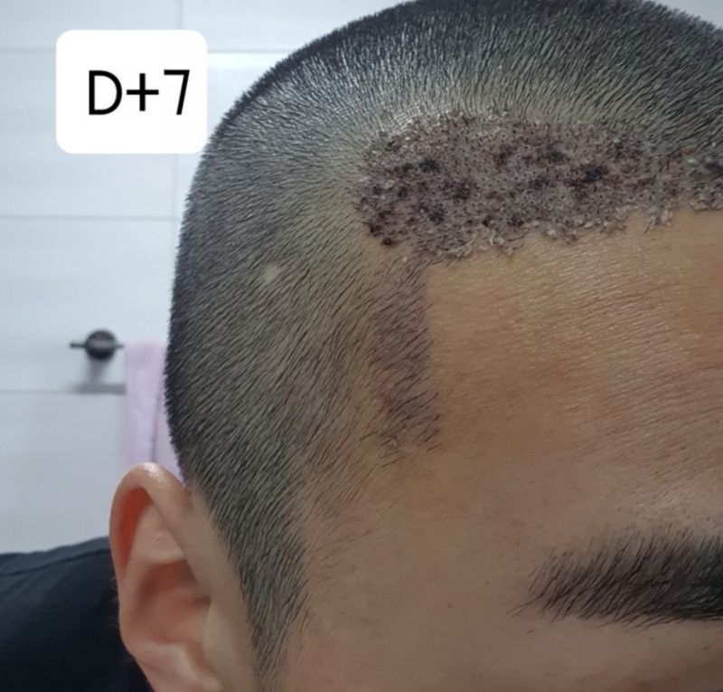 7일.PNG