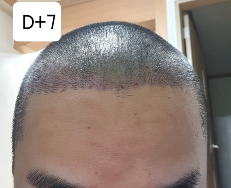 7일2.PNG