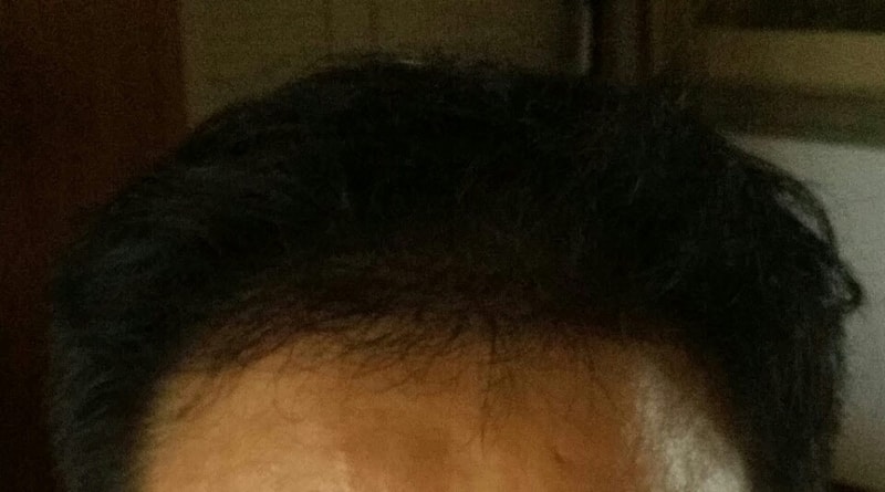 After.jpg