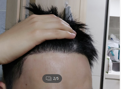 수술후4.PNG