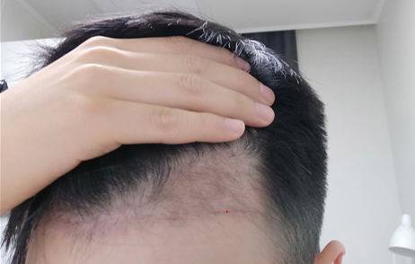 수술후.PNG