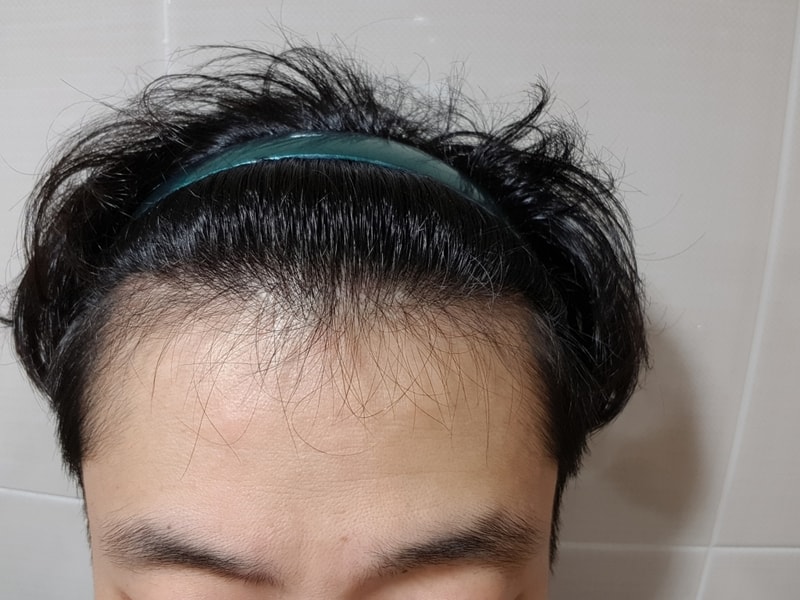정면_머리띠.jpg