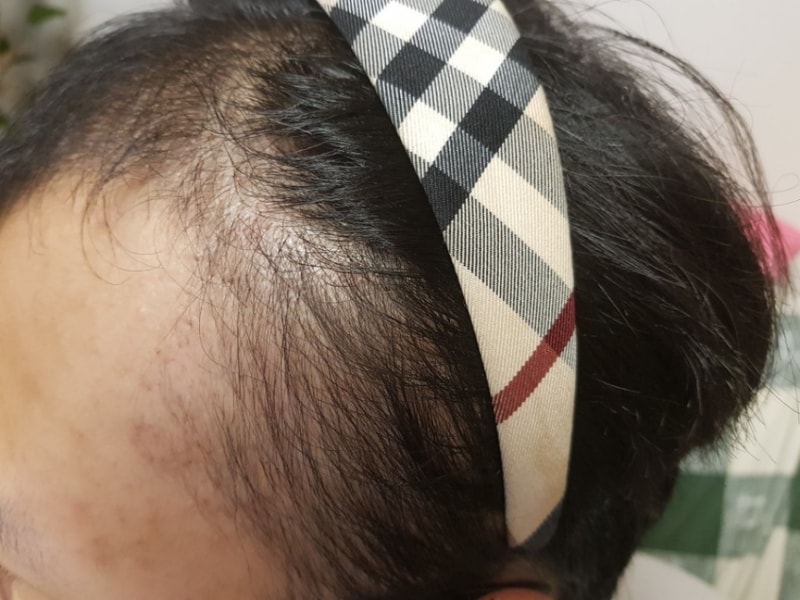 3달2.jpg