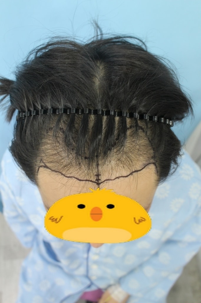일괄편집_20160406_모발_18352.jpg