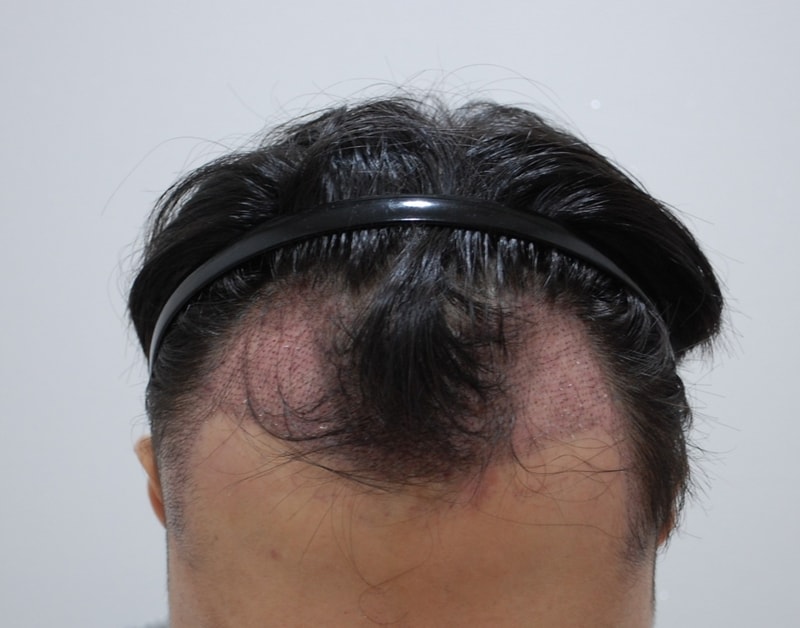 수술후.jpg