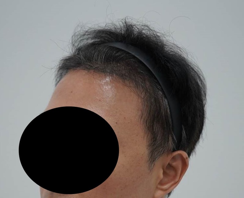 측면1.jpg