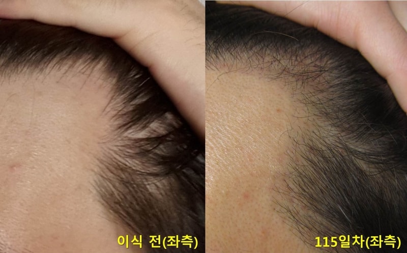 좌측.jpg