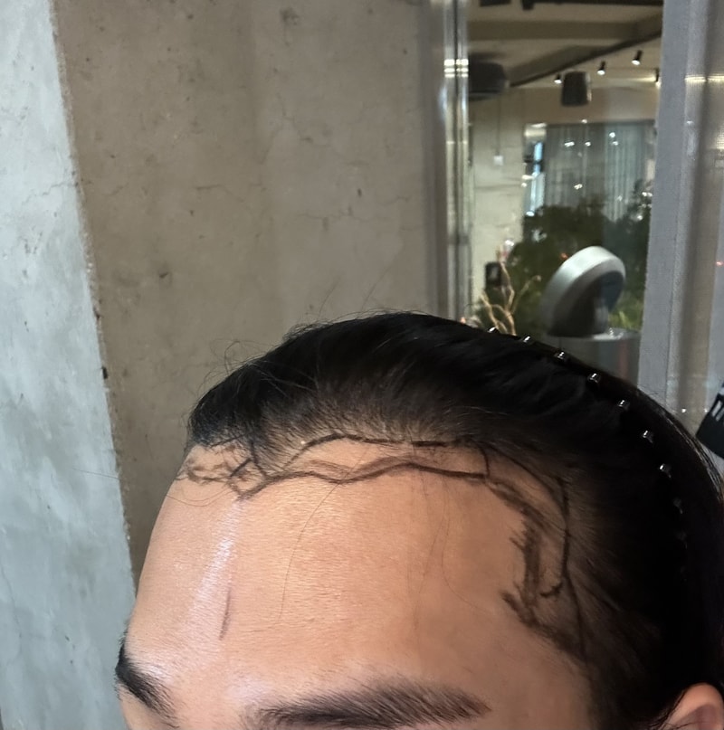 압구정 모우림의원